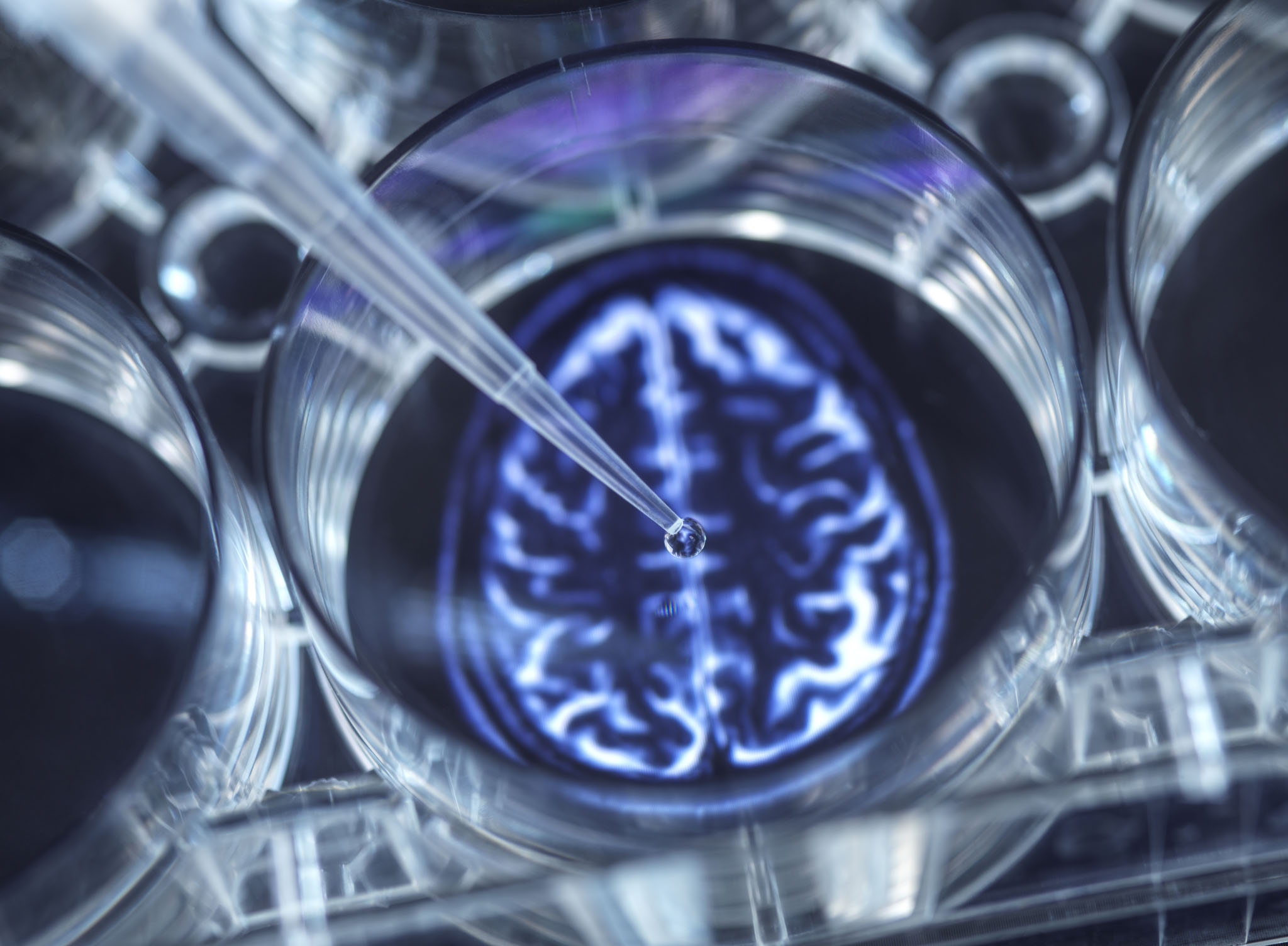 AlzeCure Pharma — ACD856: Phase I progressing after SAD data - Edison Group